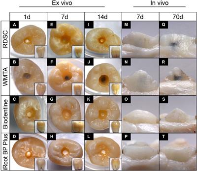 Experimental Pulp-Capping Agent Radiopaque Dicalcium Silicate Cement Facilitates Dentinogenesis